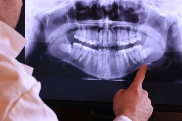 Best Emergency Root Canal Treatment in Sturgis, MI